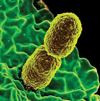 图片：彩色的扫描电子显微镜(SEM)图片显示出两个与人嗜中性粒细胞相互作用的杆状抗碳青霉烯克雷伯氏肺炎菌(CRKP)（图片蒙国家过敏与传染病研究所惠赐）。