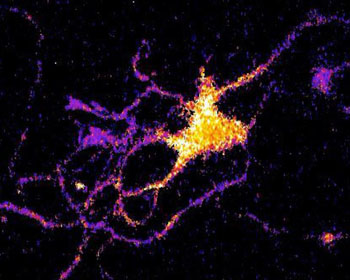 Image: Individual neuron glowing with bioluminescent light produced by a new genetically engineered sensor (Photo courtesy of the Johnson Lab, Vanderbilt University).