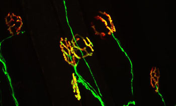 Image: The neuromuscular junction is the synapse where motor neurons communicate with muscle to initiate voluntary movement. A healthy neuromuscular junction (yellow) is characterized by perfect apposition between the motor neuron (green) and nicotinic acetylcholine receptors on the muscle (red). This synapse is damaged early in ALS, a change believed to contribute the onset and progression of the disease (Photo courtesy of the Virginia Tech Carilion Research Institute).