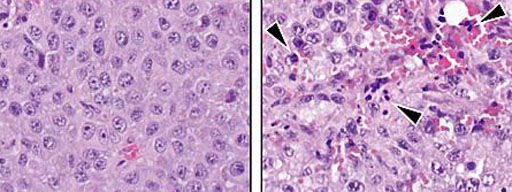 Image: The micrograph on the left is of melanoma cells growing in a mouse model. On the right, arrows point to immune cells infiltrating a tumor with LATS1/2 deleted (Photo courtesy of the University of California, San Diego).
