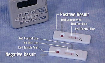 Экспресс-тест на сифилис Syphilis Health Check представляет собой качественный мембранный иммунохроматографический анализ для обнаружения антител к бледной трепонеме (возбудителю сифилиса) в цельной крови, сыворотке и плазме крови человека (фото любезно предоставлено компанией Trinity Biotech). Экспресс-тест на сифилис Syphilis Health Check представляет собой качественный мембранный иммунохроматографический анализ для обнаружения антител к бледной трепонеме (возбудителю сифилиса) в цельной крови, сыворотке и плазме крови человека (фото любезно предоставлено компанией Trinity Biotech).