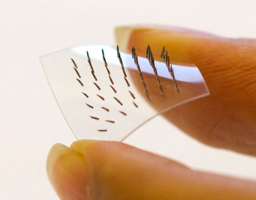 Image: The new microneedle patch was made more flexible by developing a base of molded thiol-ene-epoxy-based thermoset film. This version conformed well to deformations of the skin surface and each of its 50 needles penetrated the skin during a 30-minute test. A flexible base combined with stainless steel needles could make the patch an effective alternative for various applications (Photo courtesy of KTH Royal Institute of Technology).