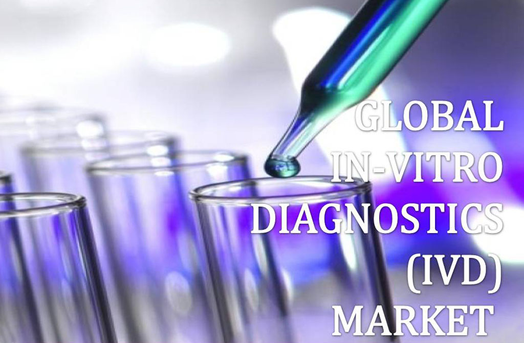 Image: Research has identified the top five IVD market trends for 2016 (Photo courtesy of Slidestoc).