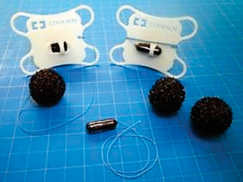 图片:细胞海绵是采样食管内襞的一种有效方法,且病人经受得住(图片蒙北卡罗莱纳大学惠赐)。 图片:细胞海绵是采样食管内襞的一种有效方法,且病人经受得住(图片蒙北卡罗莱纳大学惠赐)。