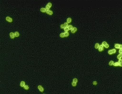 Image: A fluorescent micrograph of Streptococcus pneumoniae in spinal fluid (Photo courtesy of the CDC).
