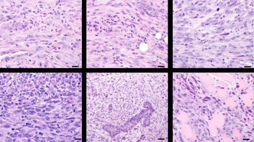 Image: Mammary tumors caused by deleting CCN6 in a mouse model look like human metaplastic carcinoma (Photo courtesy of the University of Michigan).