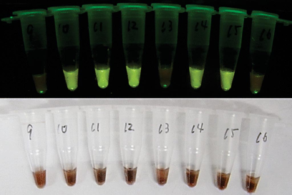 Image: Visual determination of positive and negative samples. Examples of malaria CZC-LAMP tubes after the reaction. It is not possible to determine positive or negative under natural light due to the interference by hemoglobin (lower). However, positive samples emit green fluorescence under 505 nm blue-green light (upper) (Photo courtesy of Hokkaido University School of Medicine).
