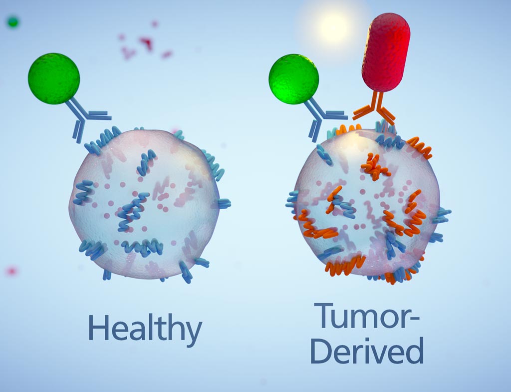 Image: A new technique for identifying tumor-derived extracellular vesicles (EVs) relies on differently shaped nanoparticle probes that refract light at different wavelengths, one spherical (green) and one rod-shaped (red). One probe identifies the surface protein ephA2 linked with pancreatic cancer; the other probe identifies a common EV surface protein. Only pancreatic cancer-derived EVs express both proteins and thus bind both nanoparticles to emit a brilliant yellow signal that allows these disease-linked EV’s to be easily detected for diagnostic purposes. This method can also be used to monitor effectiveness of anti-cancer treatment by measuring abundance of tumor-derived EV’s over the course of therapy (Photo courtesy of Arizona State University / Jason Drees).