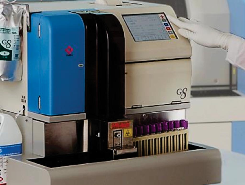 Image: The G8 HPLC analyzer for HbA1c measurement (Photo courtesy of Tosoh Bioscience).