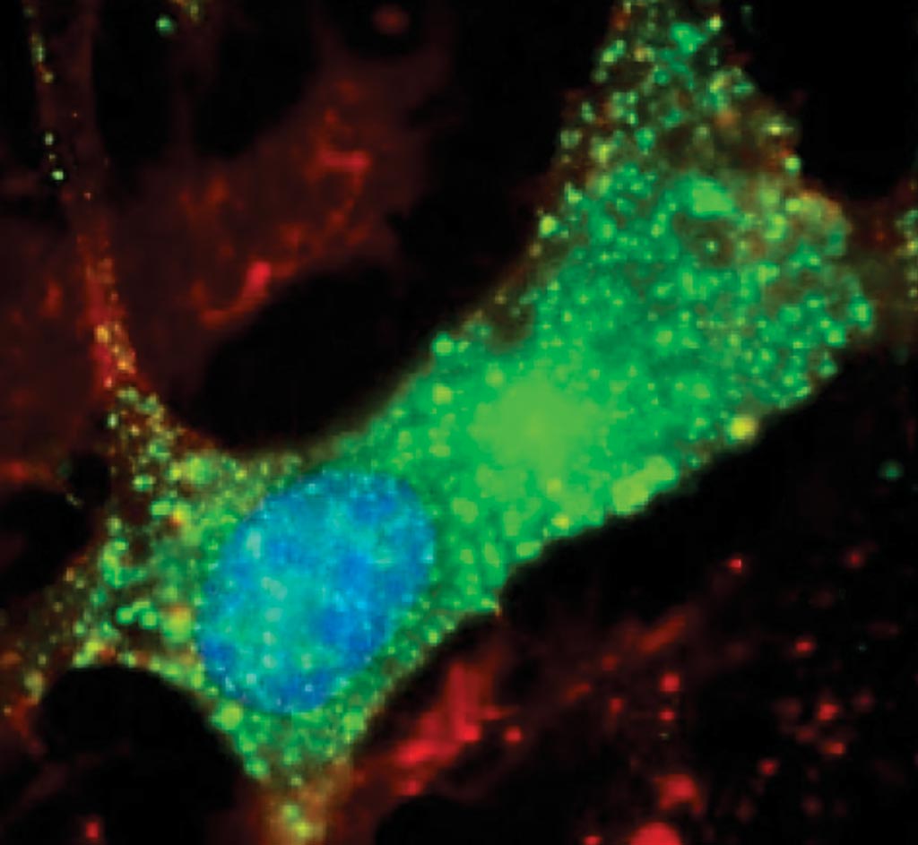 Image: New clues to Nodding syndrome: scientists discovered antibodies to leiomodin-1 (green) inside human brain cells. This study suggests that Nodding syndrome may be an autoimmune disease (Photo courtesy Dr. Avindra Nath, MD).