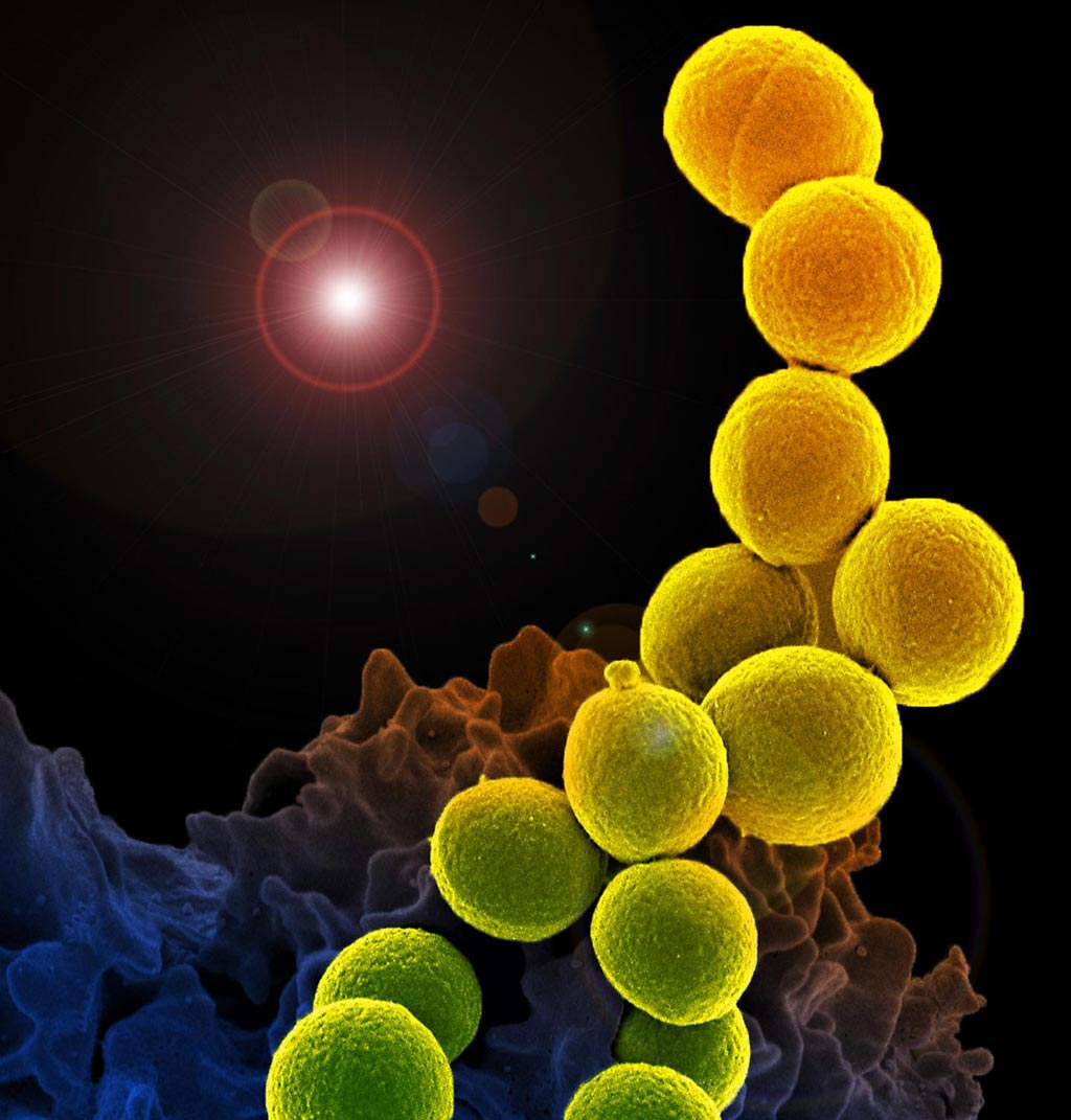 Image: Bacteria (yellow) interact with a human white blood cell. If left unchecked, this encounter might develop into sepsis (Photo courtesy of the NIAID).