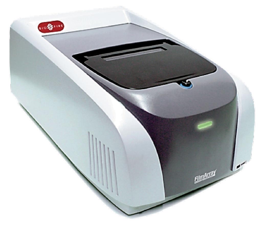 Image: The FilmArray multiplex polymerase chain reaction system used for point-of -care diagnosis of acute respiratory diseases (Photo courtesy of bioMérieux).
