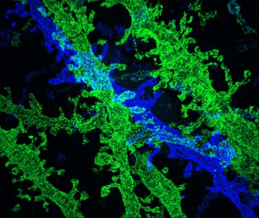 Image: High-resolution imaging with conventional confocal microscopes: by expanding brain tissue twice, researchers were able to obtain high-resolution images of neurons in the hippocampus (Photo courtesy of MIT).