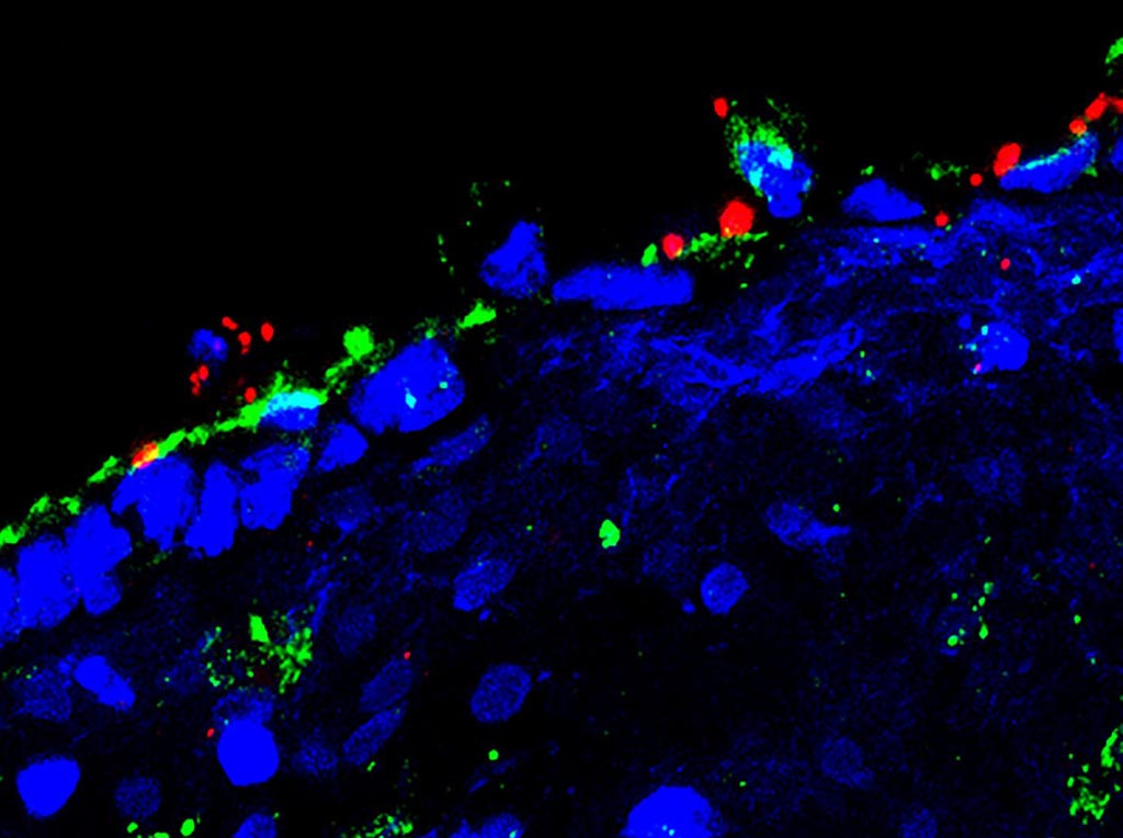 Image: Neisseria gonorrhoeae infection in human endocervical tissue is visualized by immunofluorescence microscopy. Bacterial (red) colonization causes columnar endocervical epithelial cells to shed and lose the barrier function, which allows bacteria to enter the endocervical tissue. For this image frozen tissue sections were stained for immunofluorescence with specific antibodies to the apical junctional protein ZO1 (green), N. gonorrhoeae (red), and the nuclear dye DAPI (blue) (Photo courtesy of Dr. Liang-Chun Wang, Department of Cell biology and Molecular Genetics, University of Maryland).