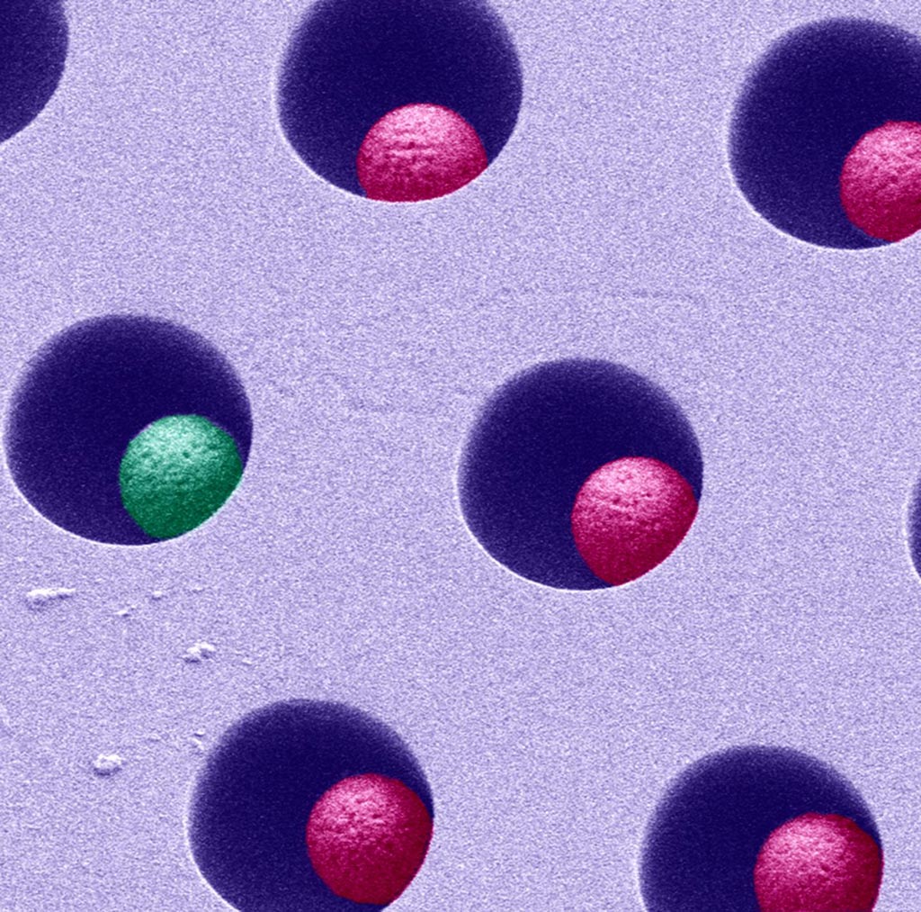 Image: A scanning electron micrograph (SEM) showing how the single-molecule array digital ELISA is carried out in tiny, femtoliter-volume wells containing beads capable of binding single molecules (Photo courtesy of Rodero MP et al).