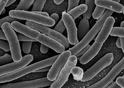 Image: Research shows that when drug-resistant bacteria such as e. coli enter the bloodstream, it can raise a person’s risk for sepsis (Photo courtesy of the CDC).