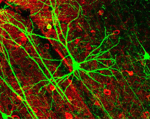 Image: Brain imaging studies have revealed differences in the volume of various brain regions between BD patients and healthy control subjects (Photo courtesy of Wikimedia Commons).