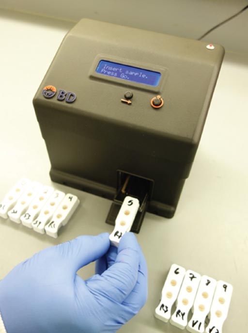 Image: The prototype device and kit for the influenza Antiviral Resistance Test (iART) (Photo courtesy of Becton Dickinson).