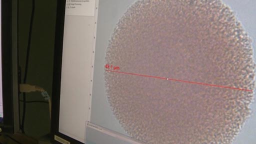Image: Researchers have devised a new microscopic tool to detect and analyze single melanoma cells that are more representative of the skin cancers developed by most patients (Photo courtesy of the University of Missouri).