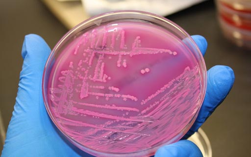 Image: E. coli (shown here growing on an agar plate) is three-fold more common in advanced NAFLD patients than early stage patients, according to a recent study (Photo courtesy of the University of California San Diego School of Medicine / J. Craig Venter Institute).