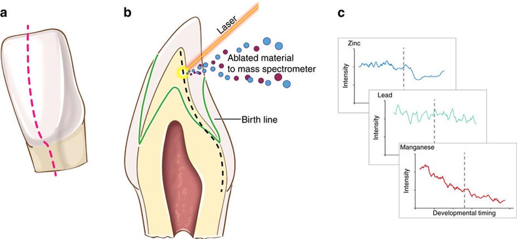 Image: An overview of tooth-matrix biomarkers applied in this study (Photo courtesy of Arora M et al / Nature Communications).