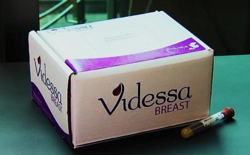 Image: The Videssa Breast protein biomarker blood test for breast cancer evaluates 11 serum protein biomarkers and 33 tumor-associated autoantibodies (Photo courtesy of Provista Diagnostics).