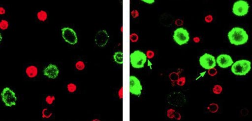 Image: A photomicrograph showing T-cells (red) and tumor cells (green) incubated with control particles (left) or immunoswitch particles (right). The T-cells that have attached to tumor cells are indicated by green arrows (Photo courtesy of Alyssa Kosmides, Johns Hopkins University).