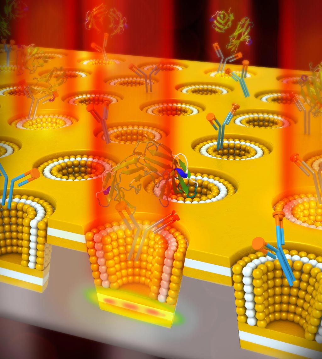Image: The new device combines two sensing methods, which had not until this time been able to be used together. It uses a 3D multi-layer nanocavity in a nanocup array, and it uses plasmonic sensing (Photo courtesy of University of Illinois).