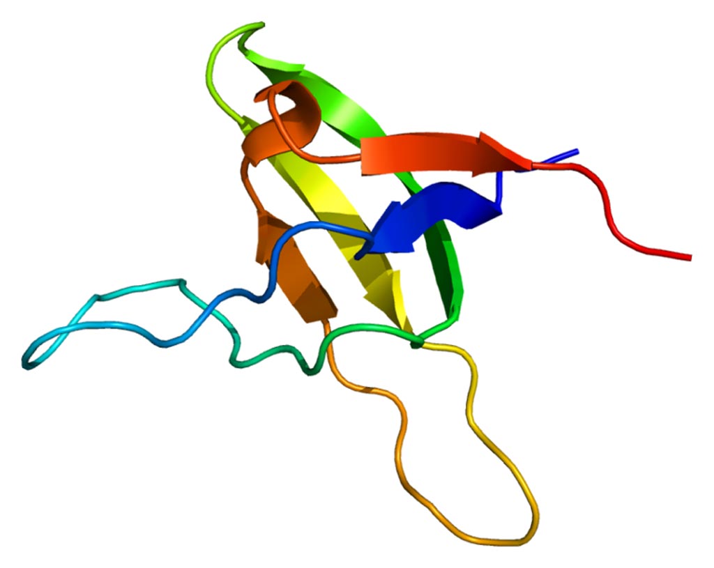 Image: The structure of the obscurin protein encoded by the OBSCN gene (Photo courtesy of Wikimedia Commons).