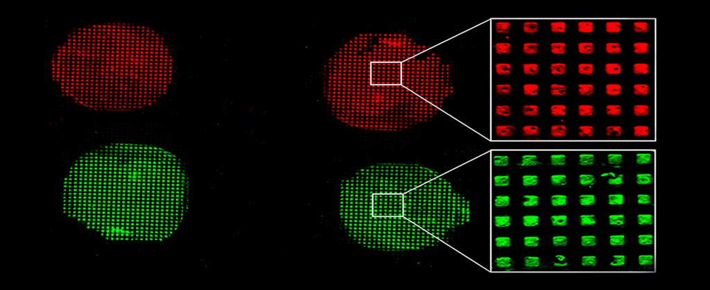 Image: Microfluidic bioassay devices are currently the preferred diagnostic tools. They measure concentration of disease biomarkers within a patient sample, such as blood, which is passed across a surface containing immobilized bioreceptors to capture the biomarker. They can indicate the likelihood of a disease based on presence/absence or based on comparison of the biomarker concentration in the sample relative to the normal body level (Image courtesy of Okinawa Institute of Science and Technology Graduate University).