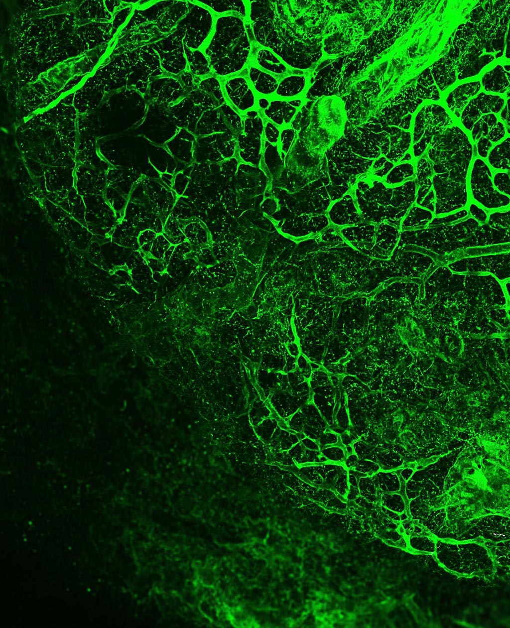 Image: The in situ decellularization of tissues (ISDoT) process reveals the ECM structure of a decellularized breast cancer lymphatic metastasis (Photo courtesy of Alejandro Mayorca-Guiliani).