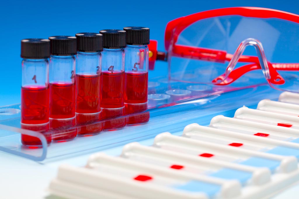 Image: A new study shows that so-called “liquid biopsies” - blood tests that detect circulating tumor DNA (ctDNA) - may not only sound an early alert that a treatment’s effect is diminishing, but may also help explain why and sometimes offer clues about what to do next (Photo courtesy of Massachusetts General Hospital).
