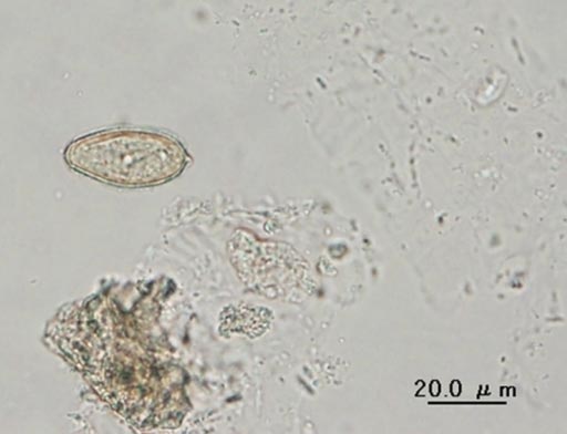 Image: A light microscopy of an egg of Amphimerus sp. observed in a fecal specimen from Ecuador, almost indistinguishable from some other liver fluke eggs (Photo courtesy of Universidad Central del Ecuador).