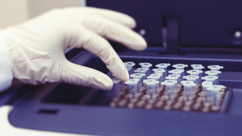 图片：研究显示，寨卡热症状常被误诊，因为其不具备特定的临床症状，因此开发能高度准确的诊断寨卡病毒的检查方法尤为重要（照片由American Society for Microbiology提供）。