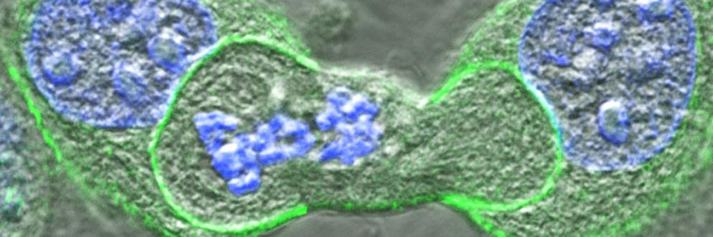 Image: A cell in the process of dividing (center) that is being engulfed by cells on either side. DNA is shown in blue and a protein responsible for attachment between cells is shown in green (Photo courtesy of Dr. Jo Durgan, Babraham Institute).