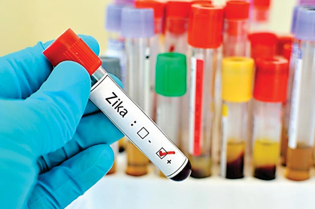 Image: A new blood test has been developed to differentiate Zika virus infection from other flaviviruses (Photo courtesy of Brett Israel, University of California-Berkeley).