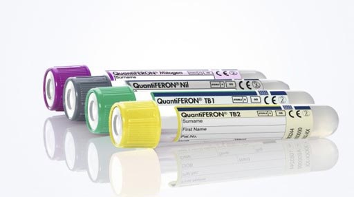 图片:新的QuantiFERON-TB Gold Plus血液检查工具,用于检测潜伏性结核病(照片由QIAGEN提供)。 图片:新的QuantiFERON-TB Gold Plus血液检查工具,用于检测潜伏性结核病(照片由QIAGEN提供)。