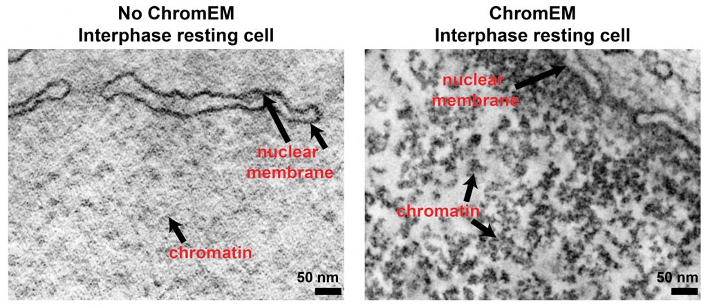 Image: Chromatin structure determines the function of the human genome. To visualize chromatin within intact cells, a method called ChromEM stains DNA and paints chromatin with a metal dust. The metal-coated chromatin is imaged by electron microscopy to generate a three-dimensional volume that reveals chromatin structure and organization. A single slice from the three-dimensional volume is shown here. Detailed chromatin structures are seen in a ChromEM stained cell (right panel, dark structures), but not in an unstained cell (left panel) (Photo courtesy of Dr. Clodagh O\'Shea, Salk Institute for Biological Studies and Dr. Mark Ellisman, University of California, San Diego).