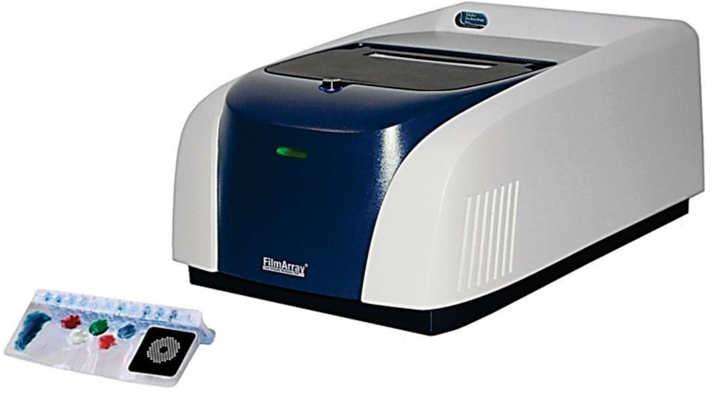 Image: The FilmArray respiratory panel enables rapid and accurate automated detection of pathogens causing respiratory infections (Photo courtesy of Idaho Technologies).
