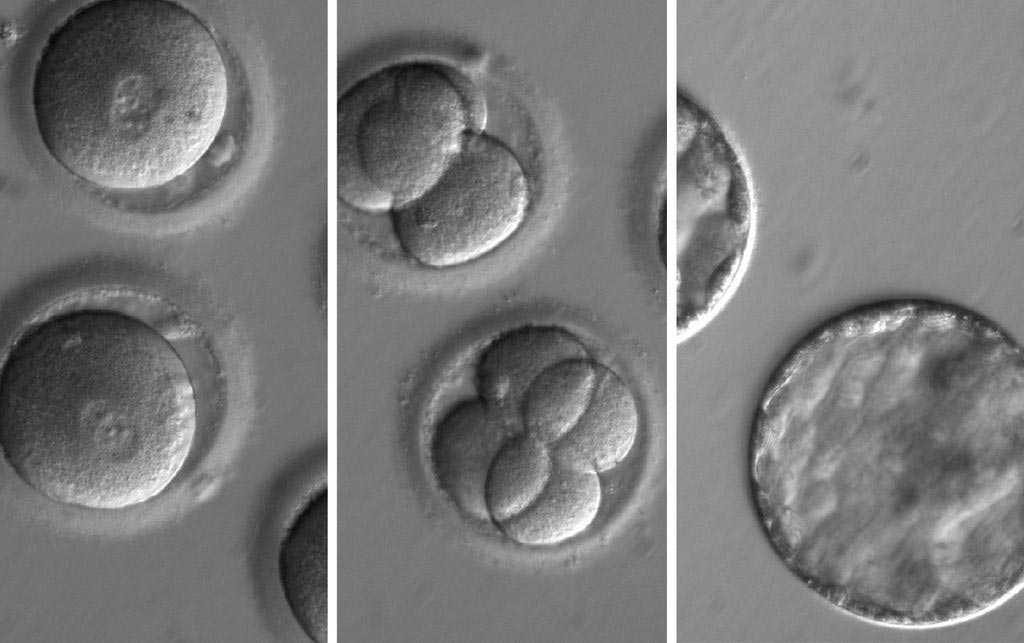 Image: A sequence of photomicrographs showing the development of embryos after co-injection of a gene-correcting enzyme and sperm from a donor with a genetic mutation known to cause hypertrophic cardiomyopathy (Photo courtesy of Oregon Health & Science University).
