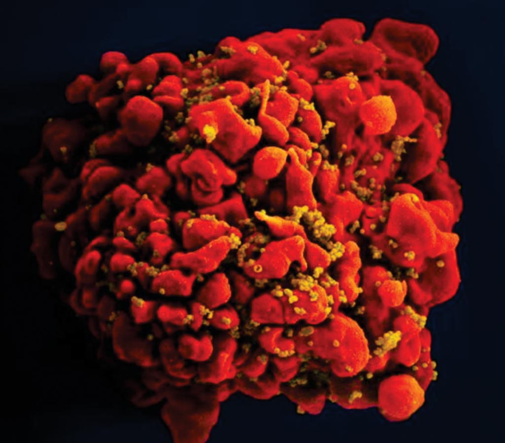 Image: A digitally colorized scanning electron micrograph of a T cell infected by numerous, spheroid-shaped, mustard-colored human immunodeficiency virus (HIV) particles, which can be seen attached to the cell\'s surface membrane (Photo courtesy of the US National Institute of Allergy and Infectious Diseases).