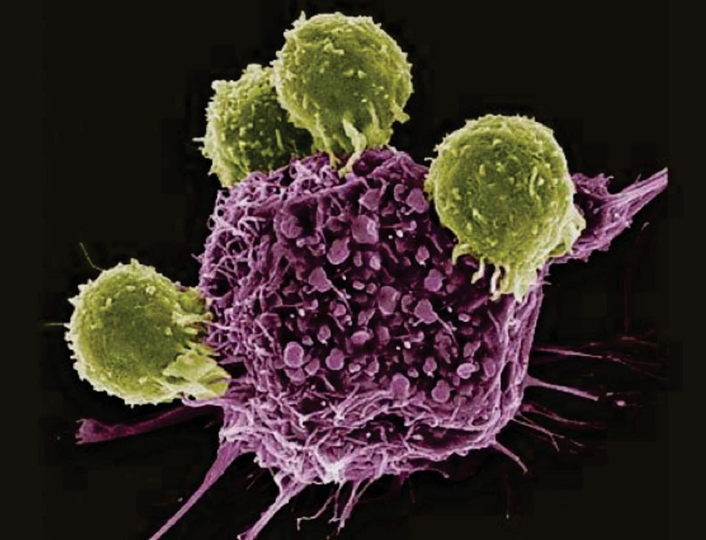 Image: A colored scanning electron micrograph (SEM) of T lymphocytes (green) bound to antigens on a cancer cell (Photo courtesy of The Scientist).
