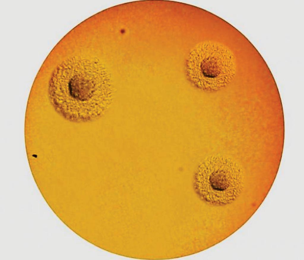 Image: The A7 Agar enables the culture, semi-quantitative enumeration and the morphological identification (solid method) of Ureaplasma urealyticum and Mycoplasma hominis (Typical “fried egg” appearance”(Photo courtesy of the ELITech Group).