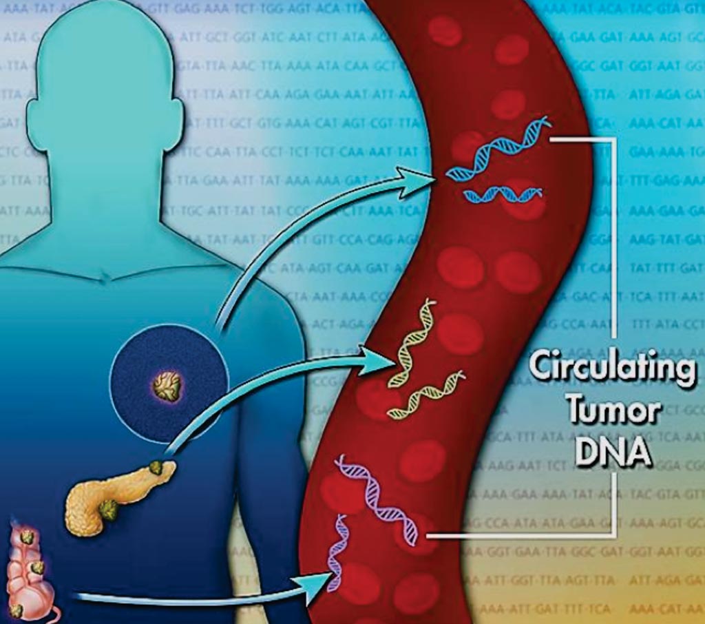 Image: The Tumor Mutation Burden test detects cell free tumor DNA in the blood and allows for stratification of patients not eligible to have a tumor biopsy (Photo courtesy of the US National Cancer Institute).