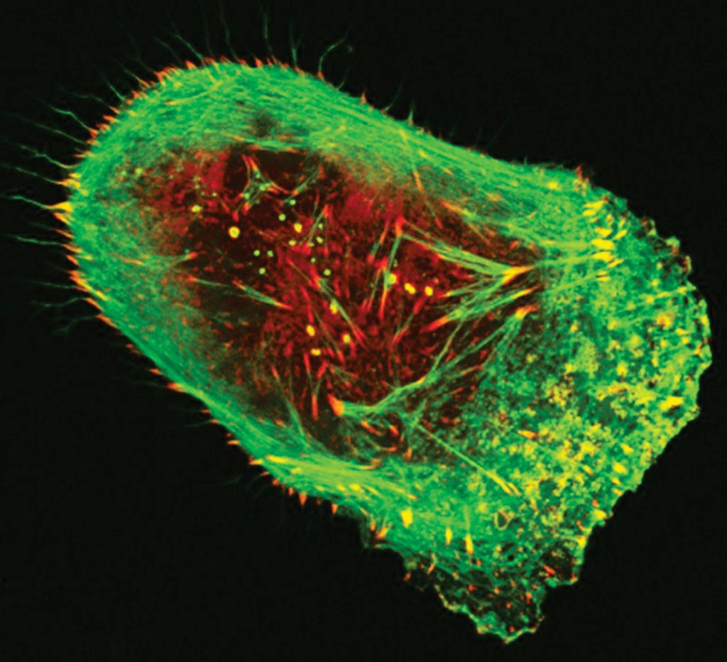 Image: A human malignant melanoma cell viewed through a fluorescent, laser-scanning confocal microscope. Invasive structures involved in metastasis appear as greenish-yellow dots, while actin (green) and vinculin (red) are components of the cell’s cytoskeleton (Photo courtesy of Vira V. Artym, PhD, PMP).