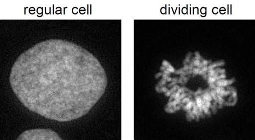 Image: A photomicrograph of chromosomes in uncondensed form (left) and condensed form in dividing cell (right) (Photo courtesy of Dr. Kenneth Zaret, University of Pennsylvania).