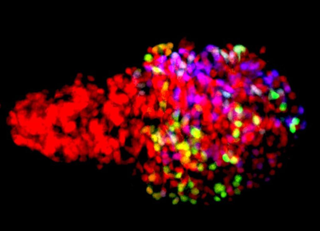 Image: Zebrafish β-cells labeled using the newly developed Beta-bow system through the combinatorial expression of fluorescent proteins, allowing the developmental history of β-cells to be traced during islet growth (Photo courtesy of and Ninov Lab, TU Dresden).