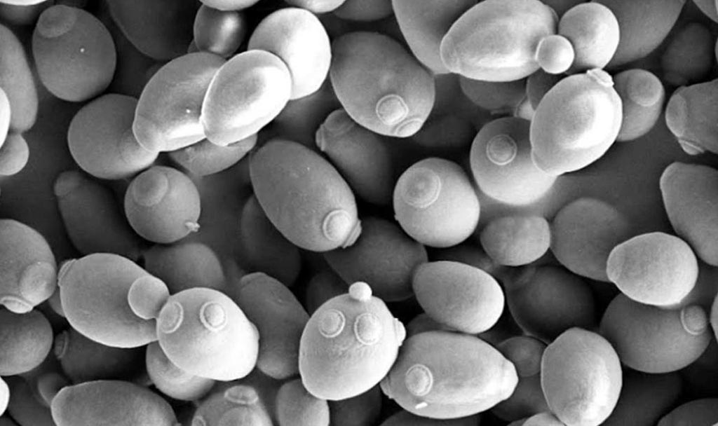 Image: A scanning electron microscope (SEM) image of the Parkinson\'s disease model yeast Saccharomyces cerevisiae (Photo courtesy of Wikimedia Commons).