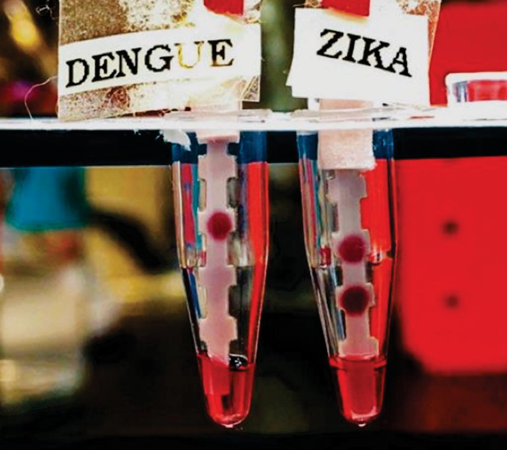 Image: Dipstick tests for dengue (left) and Zika (right) accurately identify the presence of Zika virus protein in a sample (Photo courtesy of Massachusetts Institute of Technology).