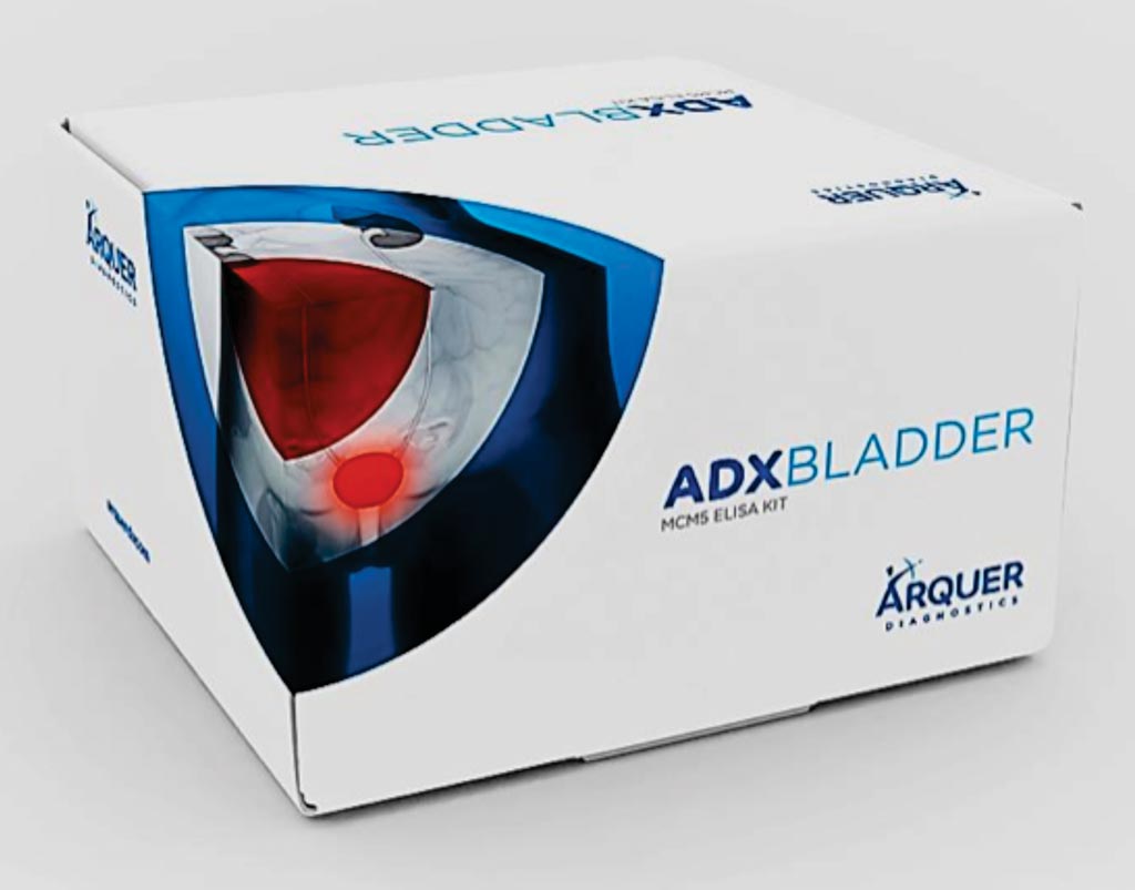 Image: The ADXBLADDER MCM5 ELISA kit for the diagnosis of bladder cancer (Photo courtesy of Arquer Diagnostics).